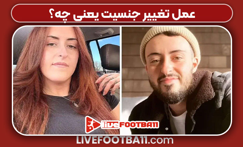 عمل تغییر جنسیت یعنی چه؟