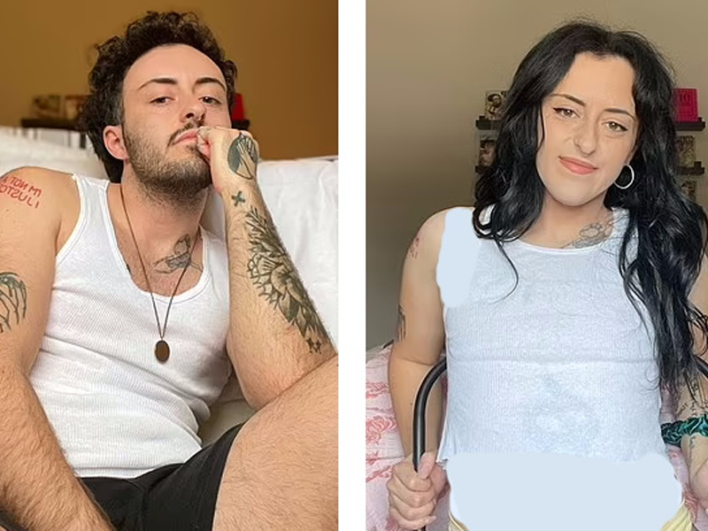 تخلیه رحم و تخمدان ها در تغییر جنسیت 